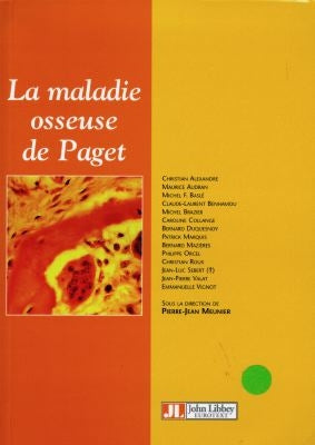 La maladie osseuse de Paget : diagnostic et stratégie thérapeutique Medicine