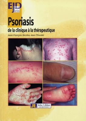 European Journal of Dermatology. Psoriasis : de la clinique à la thérapeutique book