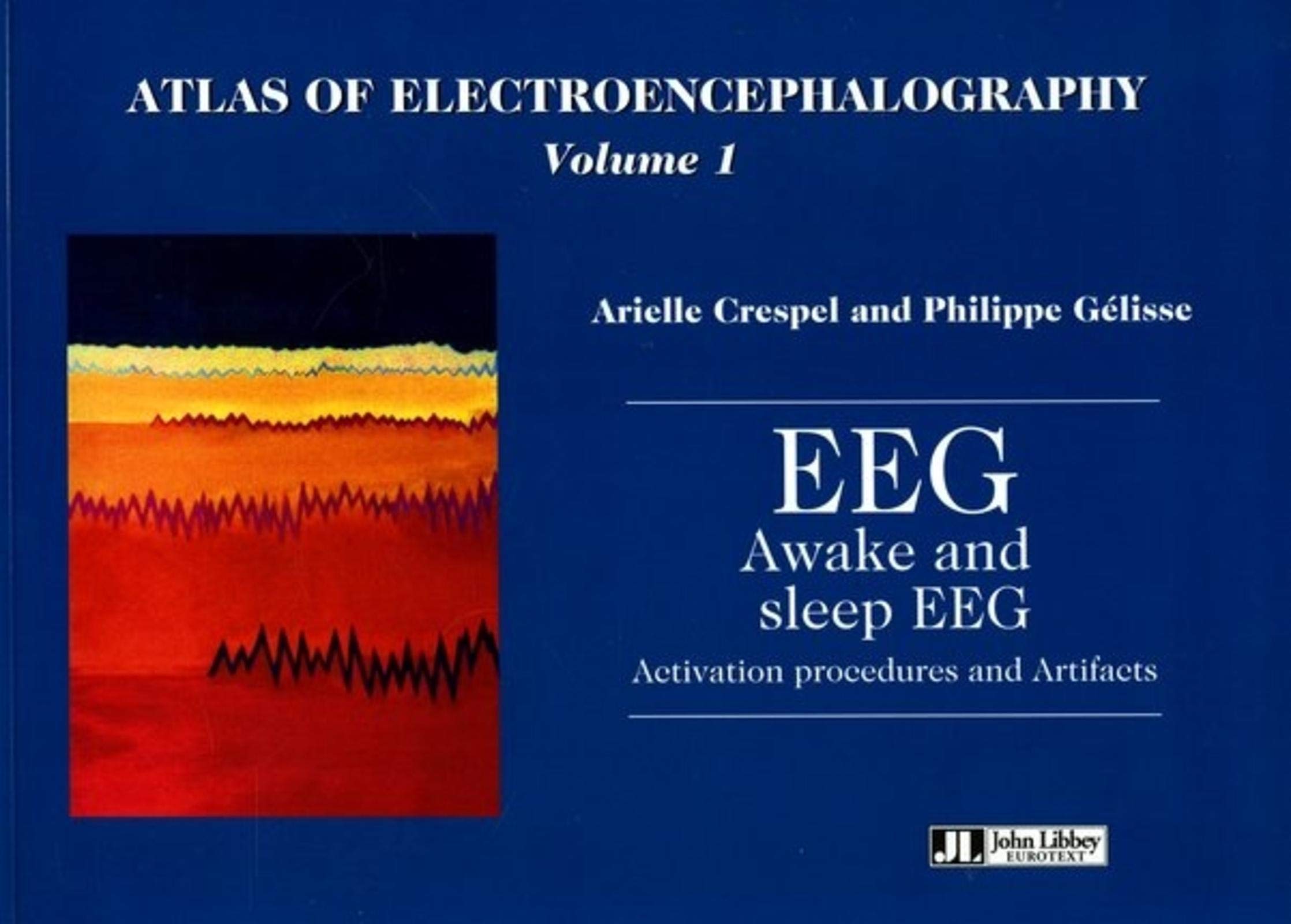 EEG Awake and Sleep EEG Activation Procedures and Artifacts (v. 1) (Atlas of Electroencephalography, Band 1) Medicine