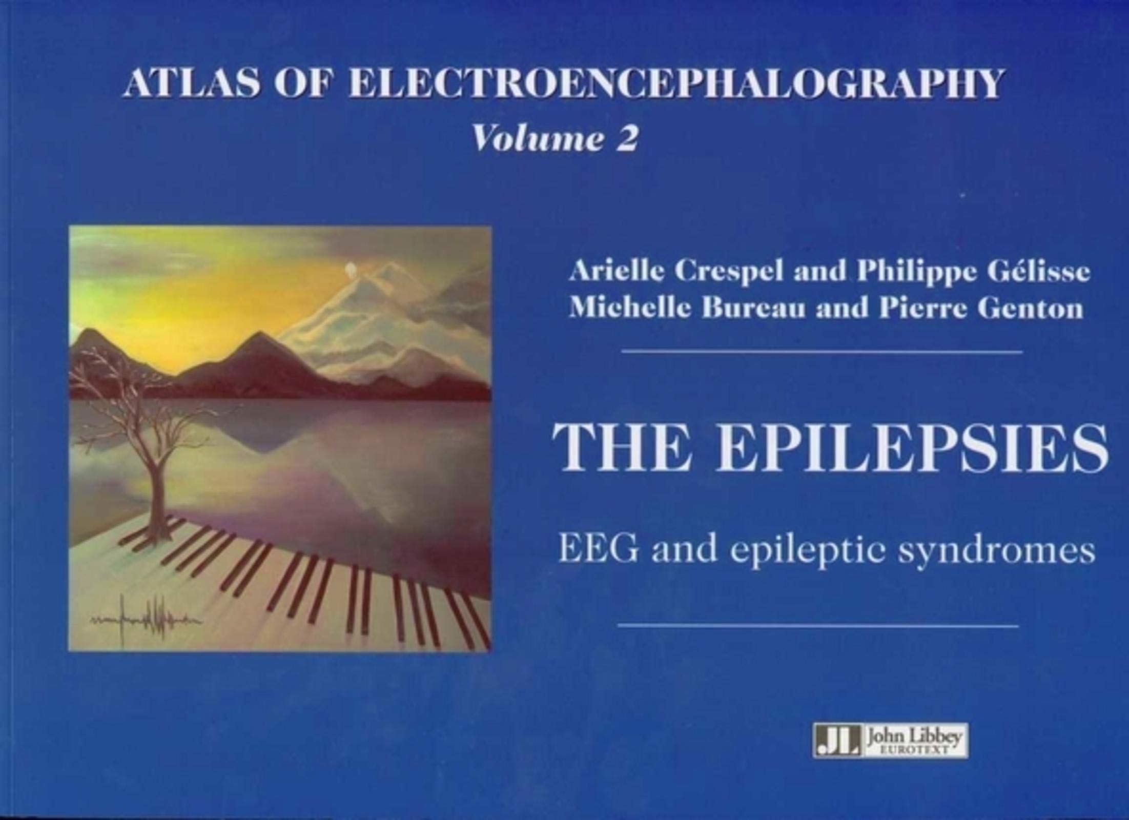 Atlas of Electroencephalography: Volume 2: The Epilepsies -- EEG & Epileptic Syndromes book