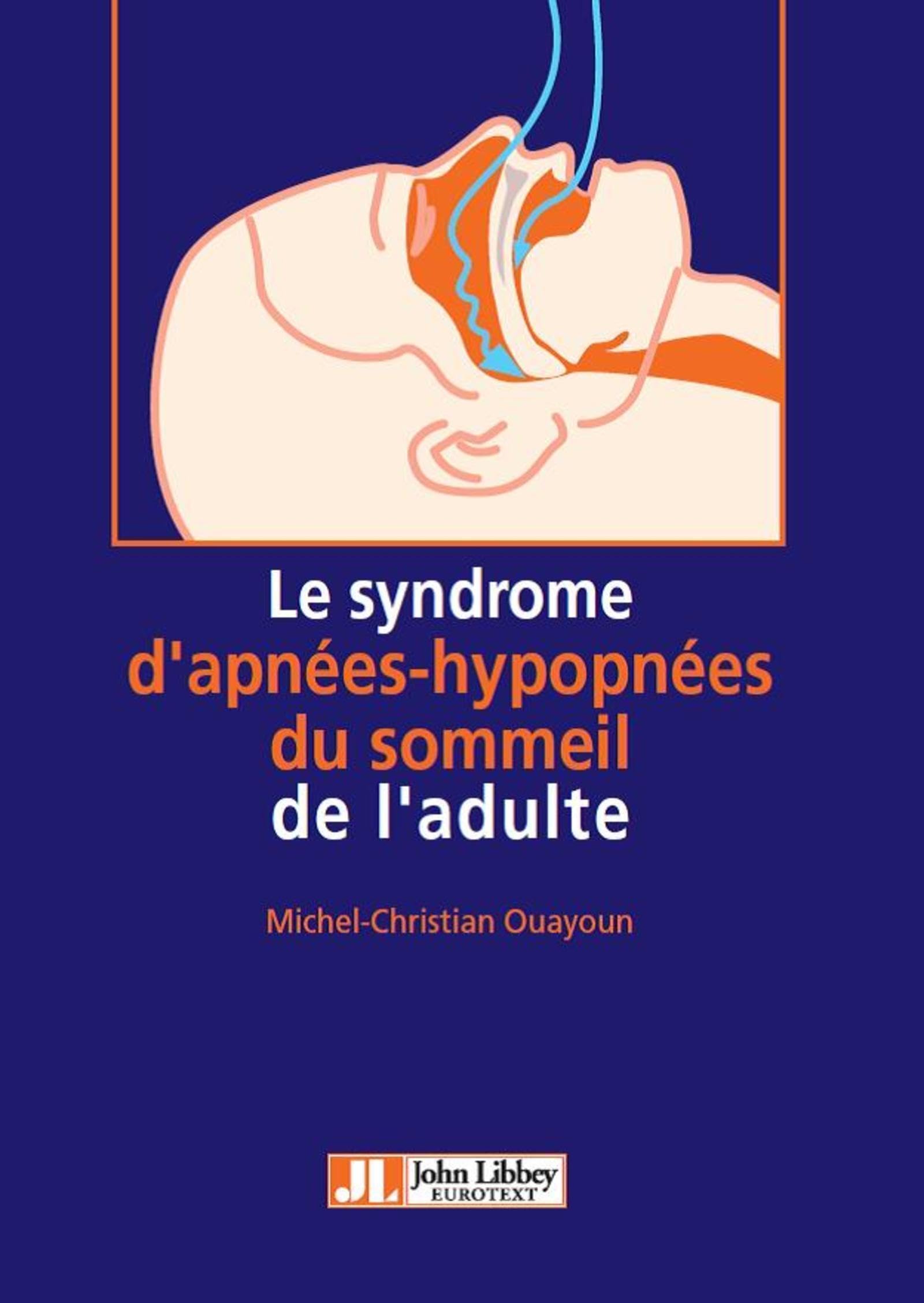Le syndrome d'apnées-hypopnées du sommeil de l'adulte Medicine