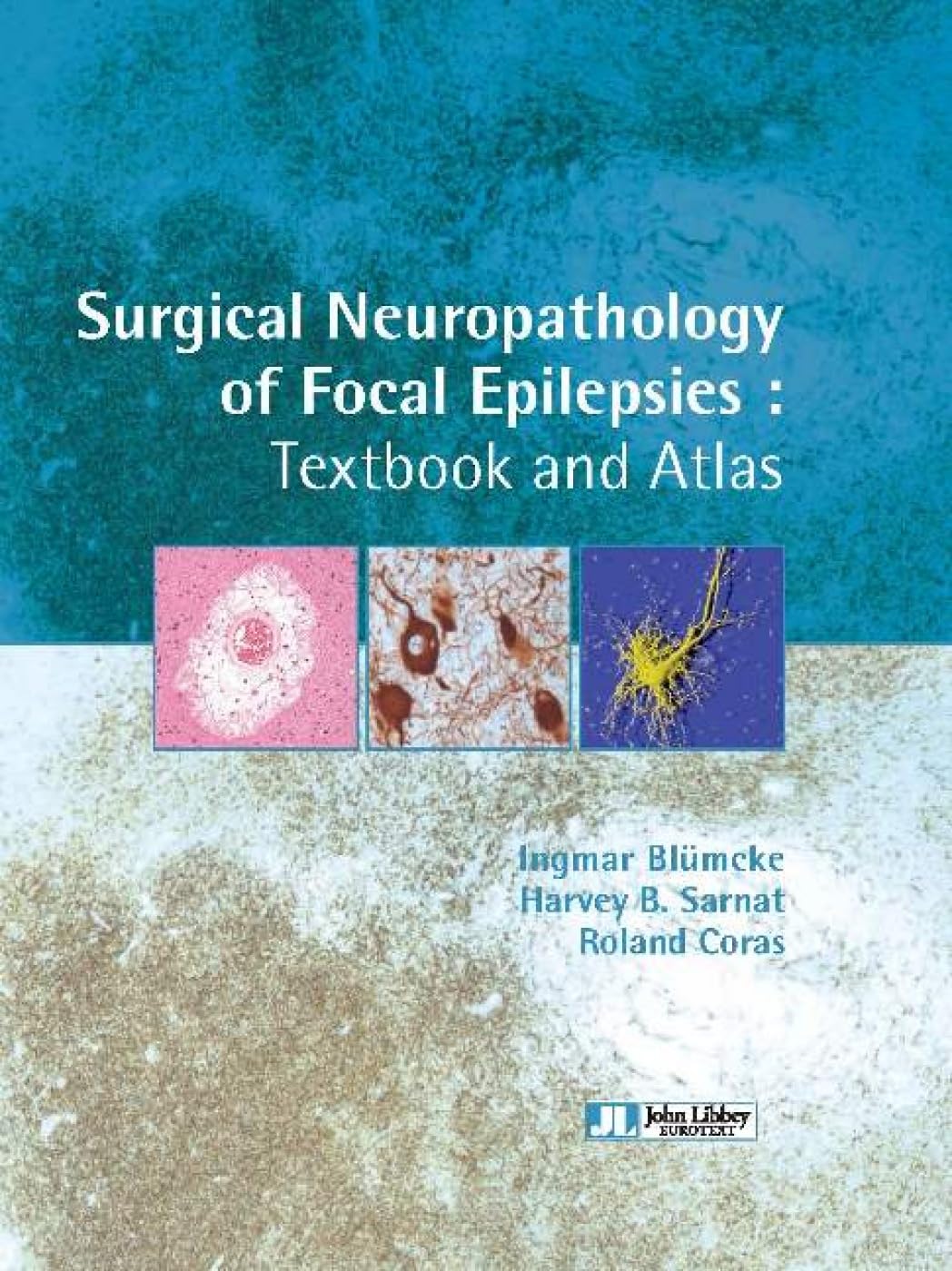 Surgical neuropathology of focal epilepsies: Textbook and atlas. book