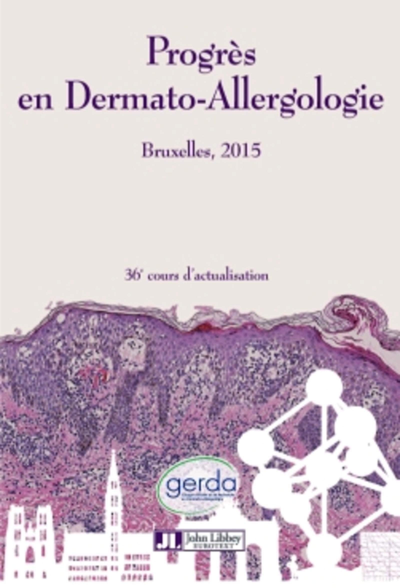 Progrès en Dermato-Allergologie - GERDA Bruxelles 2015: 36e cours d'actualisation. book