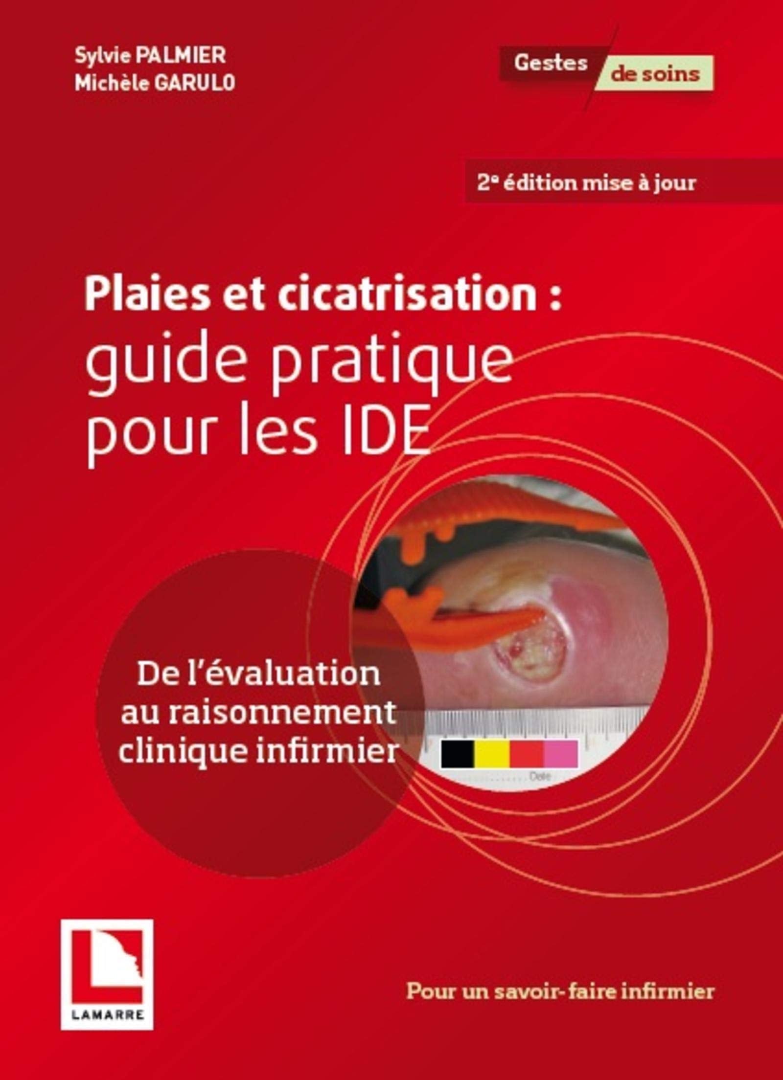 Plaies et cicatrisation: guide pratique pour les IDE: De l'évaluation au raisonnement clinique infirmier Medicine