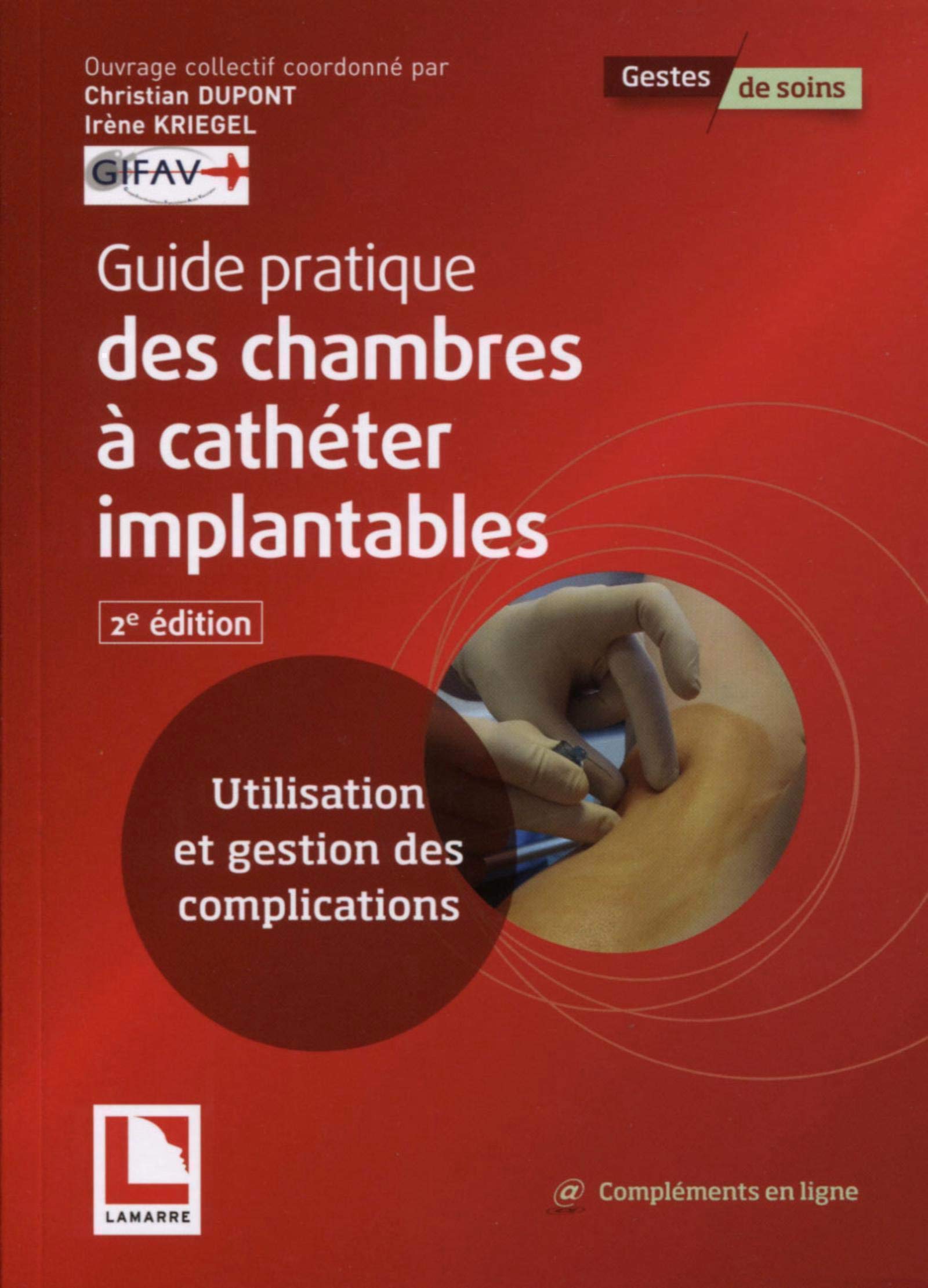 Guide pratique des chambres à cathéter implantables: Utilisation et gestion des complications book
