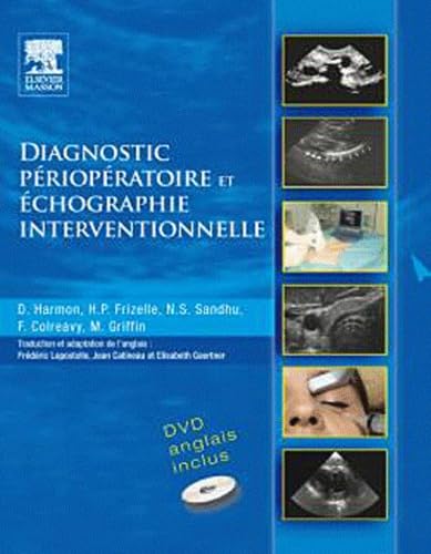 Diagnostic périopératoire et écographie interventionnelle (avec DVD) book