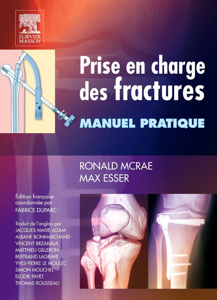 Prise en charge des fractures: Manuel pratique book