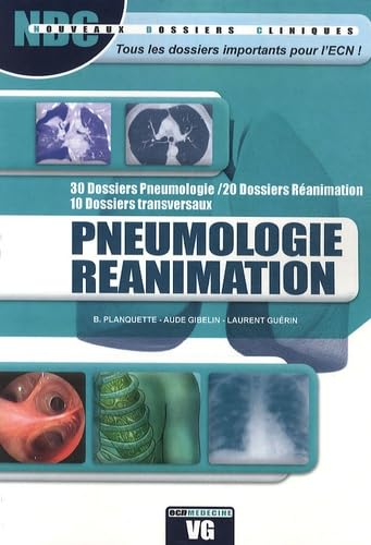 Pneumologie réanimation book