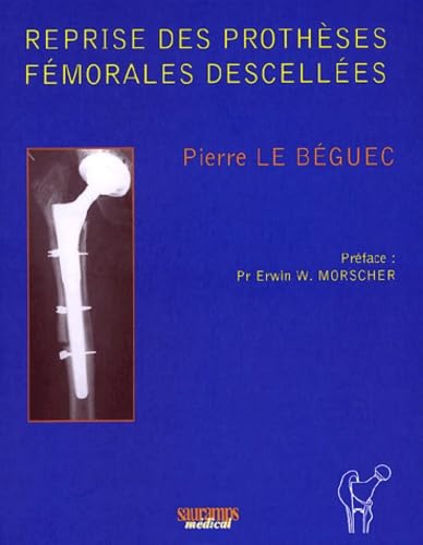 Reprise des prothèses fémorales descellées book