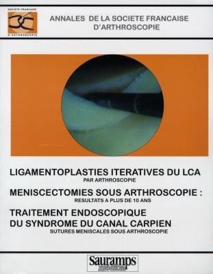 Ligamentoplasties itératives du LCA par arthroscopie. Meniscectomies sous arthroscopie : résultats à plus de 10 ans. Traitement endoscopique du syndrome du canal carpien book