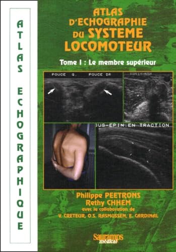 ATLAS ECHOGRAPHIQUE DU SYSTEME LOCOMOTEUR - TOME 1 MEMBRE SUPERIEUR (0001) Medicine