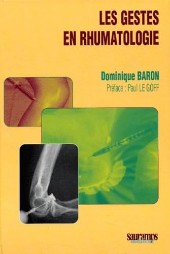 LES GESTES EN RHUMATOLOGIE Medicine
