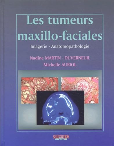 LES TUMEURS MAXILLO-FACIALES book