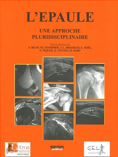 L'EPAULE UNE APPROCJE PLURIDISCIPLINAIRE: une approche pluridisciplinaire Medicine
