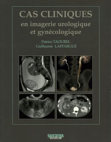 CAS CLINIQUES EN IMAGERIE UROLOGIQUE ET GYNECOLOGIQUE Medicine