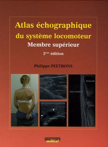 ATLAS ECHOGRAPHIQUE DU SYSTEME LOCOMOTEUR - MEMBRE SUPERIEUR 2EME EDITION (0000): Tome 1, Membre supérieur Medicine
