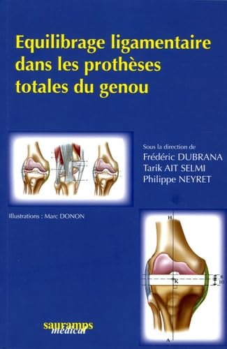 EQUILIBRAGE LIGAMENTAIRE DANS LES PROTHESES TOTALES DU GENOU Medicine