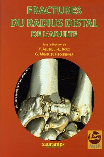 FRACTURES DU RADIUS DISTAL DE L ADULTE Medicine