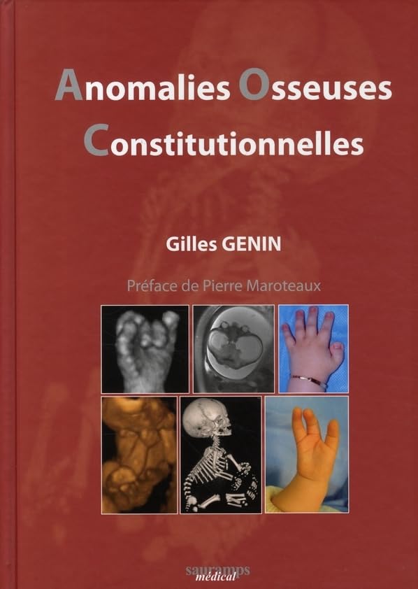 ANOMALIES OSSEUSES CONSTIUTIONNELLES (0000) book