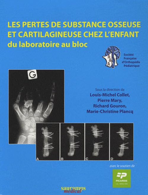 LES PERTES DE SUBSTANCE OSSEUSE ET CARTILAGINEUSE CHEZ L'ENFANT. DU LABORATOIRE book