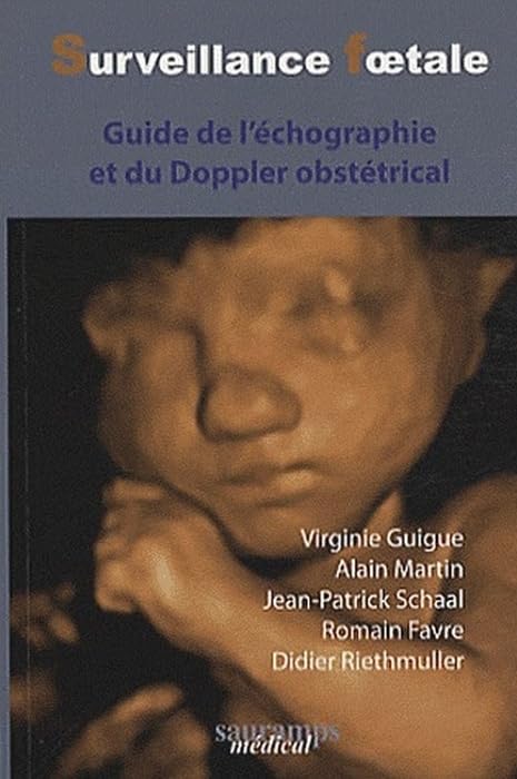 SURVEILLANCE FOETALE ECHO DOPPLER 2ED: Guide de l'échographie et du Doppler obstétrical Medicine