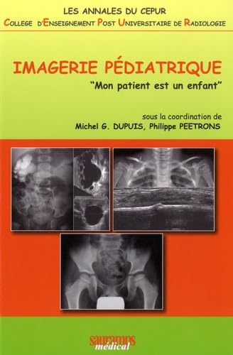 L'IMAGERIE PEDIATRIQUE CEPUR: "Mon patient est un enfant" Medicine