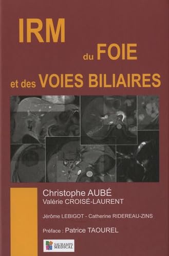 IMAGERIE DU FOIE ET DES VOIES BILIAIRES book