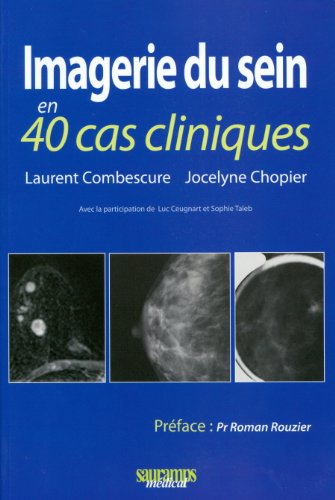 Imagerie du sein en 40 cas cliniques Medicine