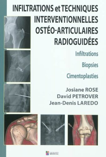 INFILTRATIONS ET TECHNIQUES INTERVENTIONNELLES OSTEO-ARTICULAIRES RADIOGUIDEES (0000) book
