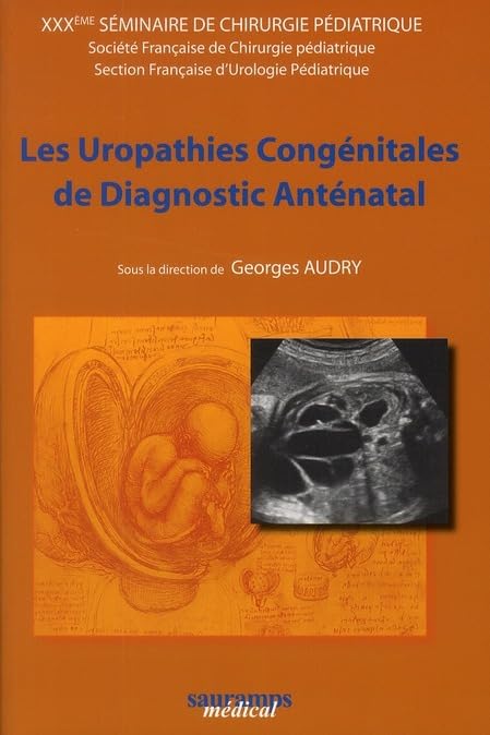 LES UROPATHIES CONGENITALES DE DIAGNOSTIC PRENATAL: 30e séminaire de chirurgie pédiatrique Medicine