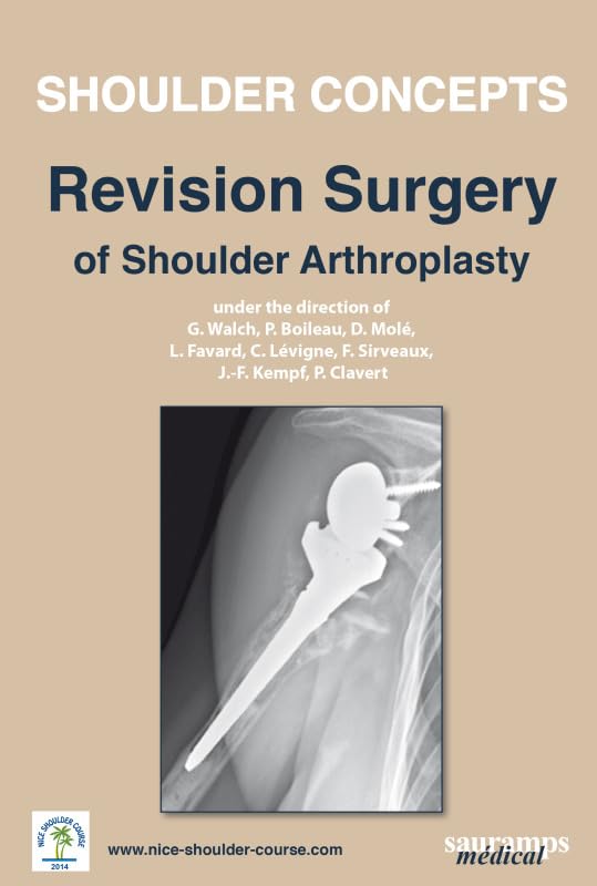 SHOULDER CONCEPTS - REVISION SURGERY OF SHOULDER ARTHROPLASTY 2014 book