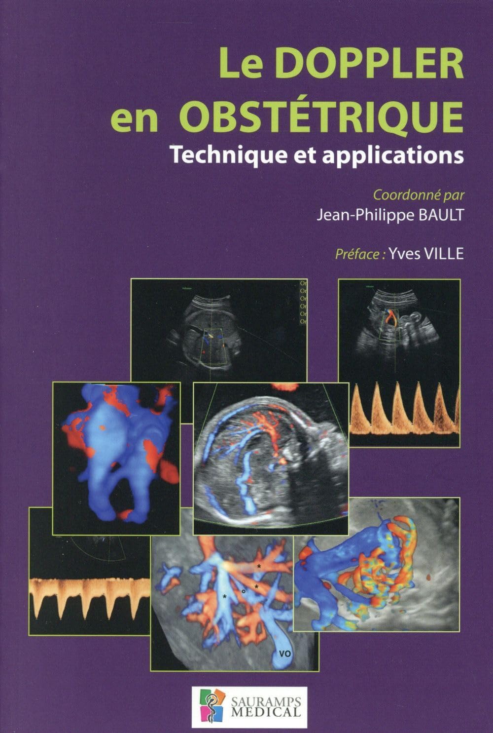 LE DOPPLER EN OBSTETRIQUE. TECHNIQUE ET APPLICATIONS Medicine