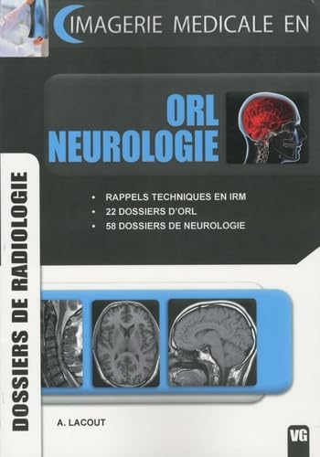 ORL neurologie: Dossiers de radiologie book
