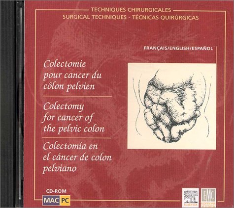 Colectomy for Cancer of the Pelvic Colon Medicine