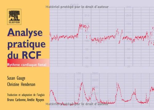 Analyse pratique du RCF: Rythme cardiaque foetal book