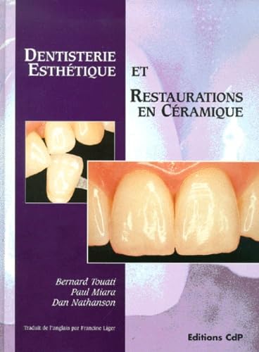 Dentisterie esthétique et restauration céramique book
