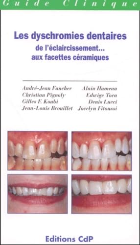 Les Dyschromies Dentaires : De L'Eclaircissement... Aux Facettes Ceramiques Books