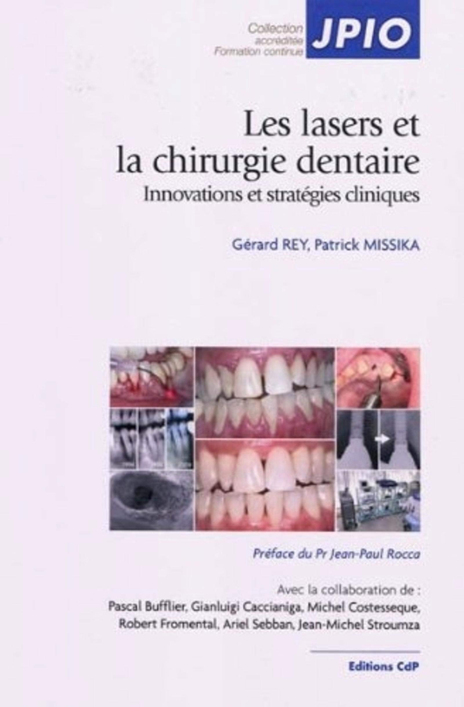 Les lasers et la chirurgie dentaire: Innovations et stratégies cliniques Medicine