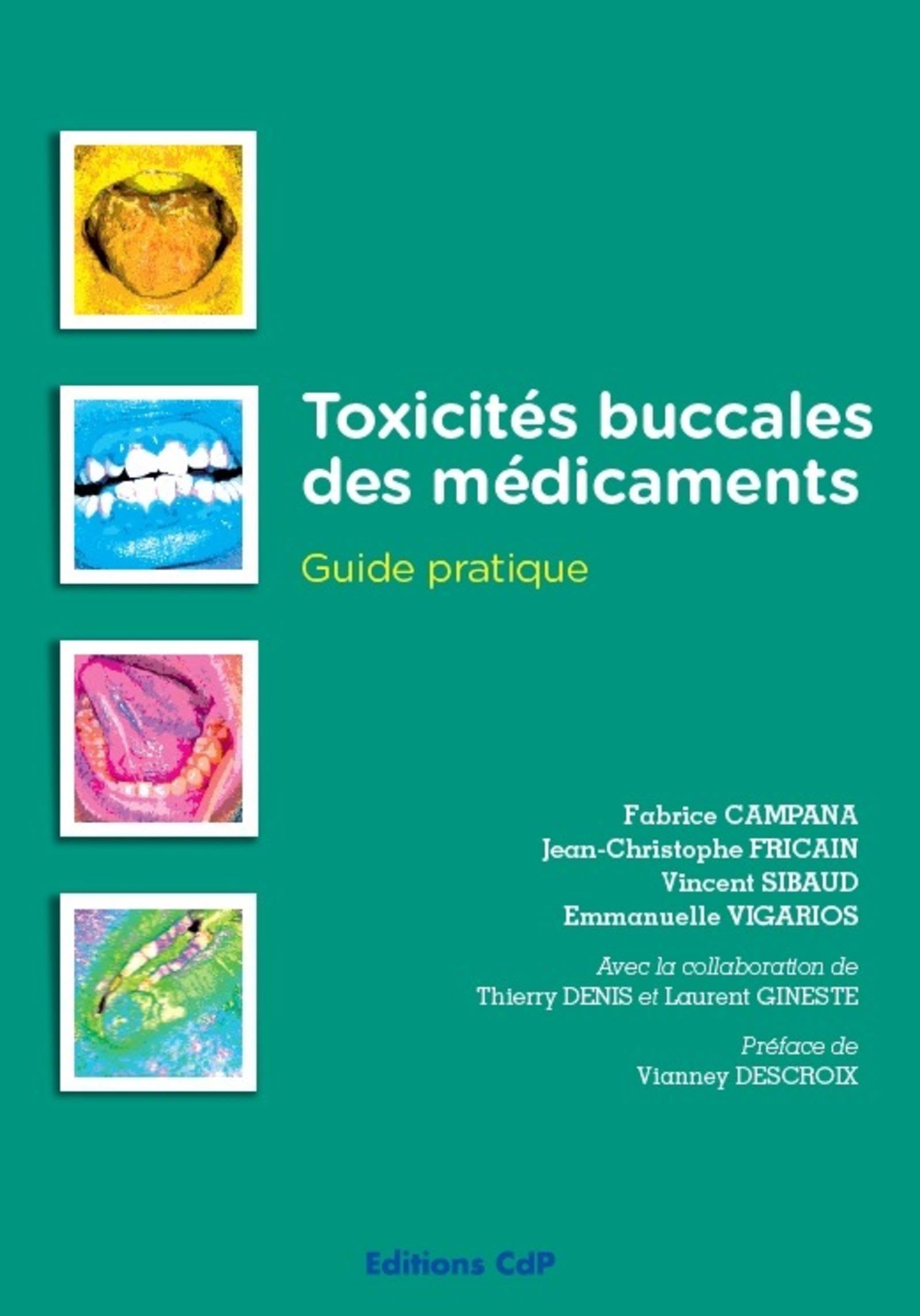 Toxicités buccales des médicaments: Guide pratique Medicine