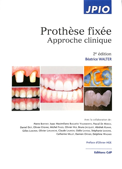 Product Image: Prothèse fixée : approche clinique