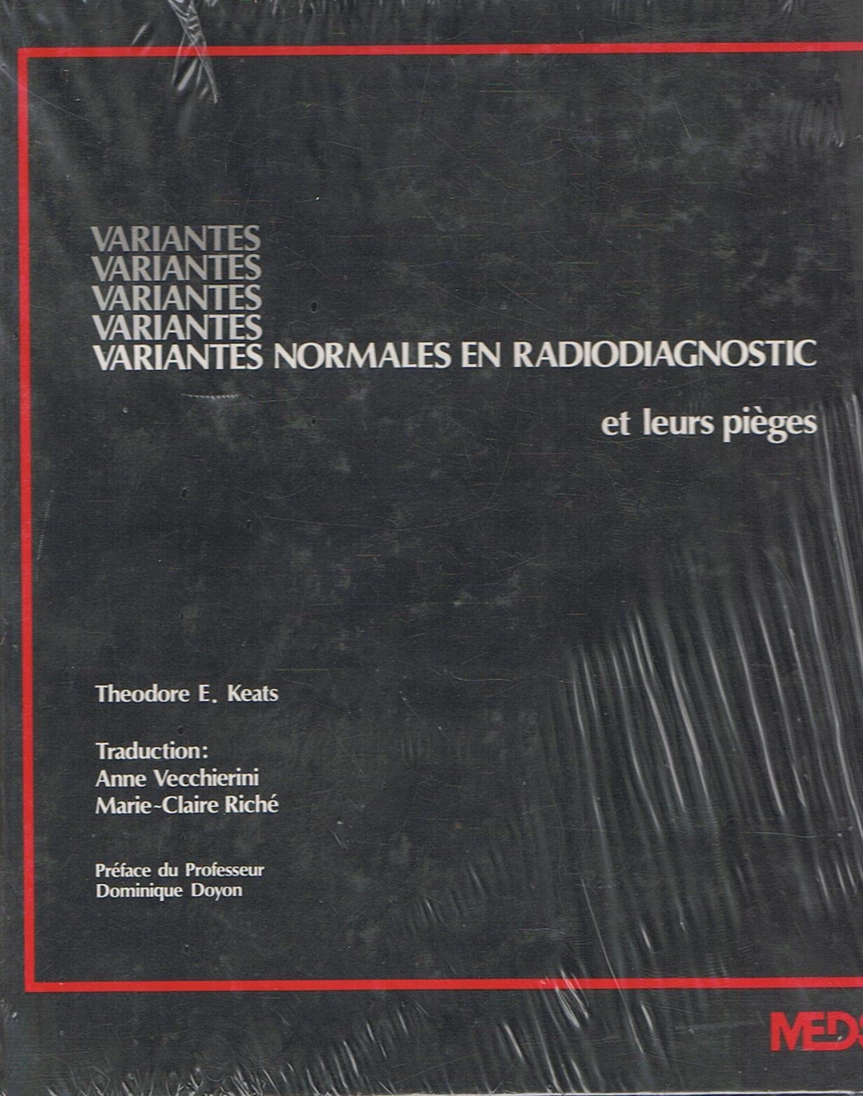 Variantes normales en radiodiagnostic et leurs pièges book