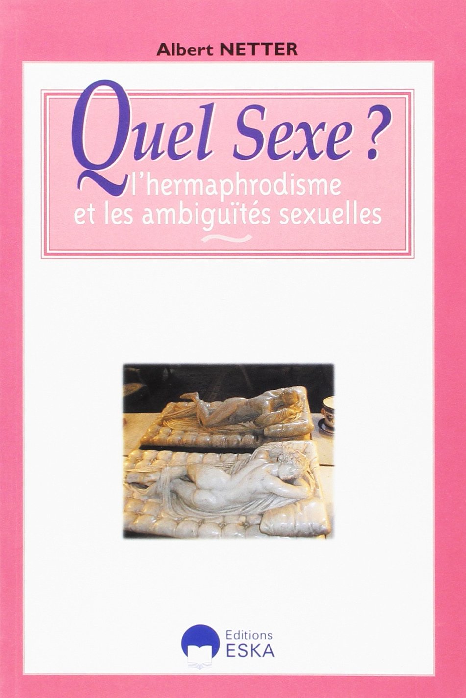 Quel sexe ? : l'hermaphrodisme et les ambiguïtés sexuelles Medicine