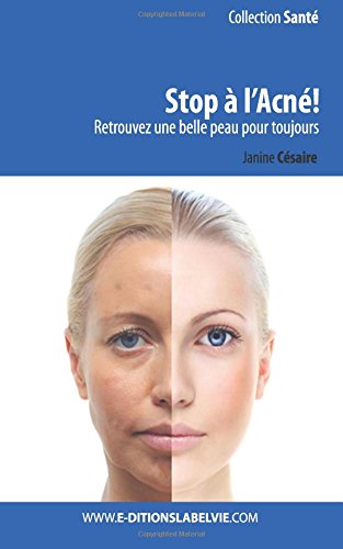 Stop à l'acné !: Retrouvez une belle peau pour toujours book