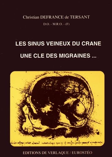 Les sinus veineux du crâne : une clé des migraines Medicine