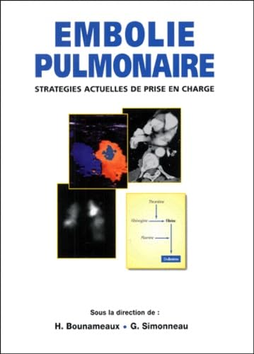 EMBOLIE PULMONAIRE.: Stratégies actuelles de prise en charge book