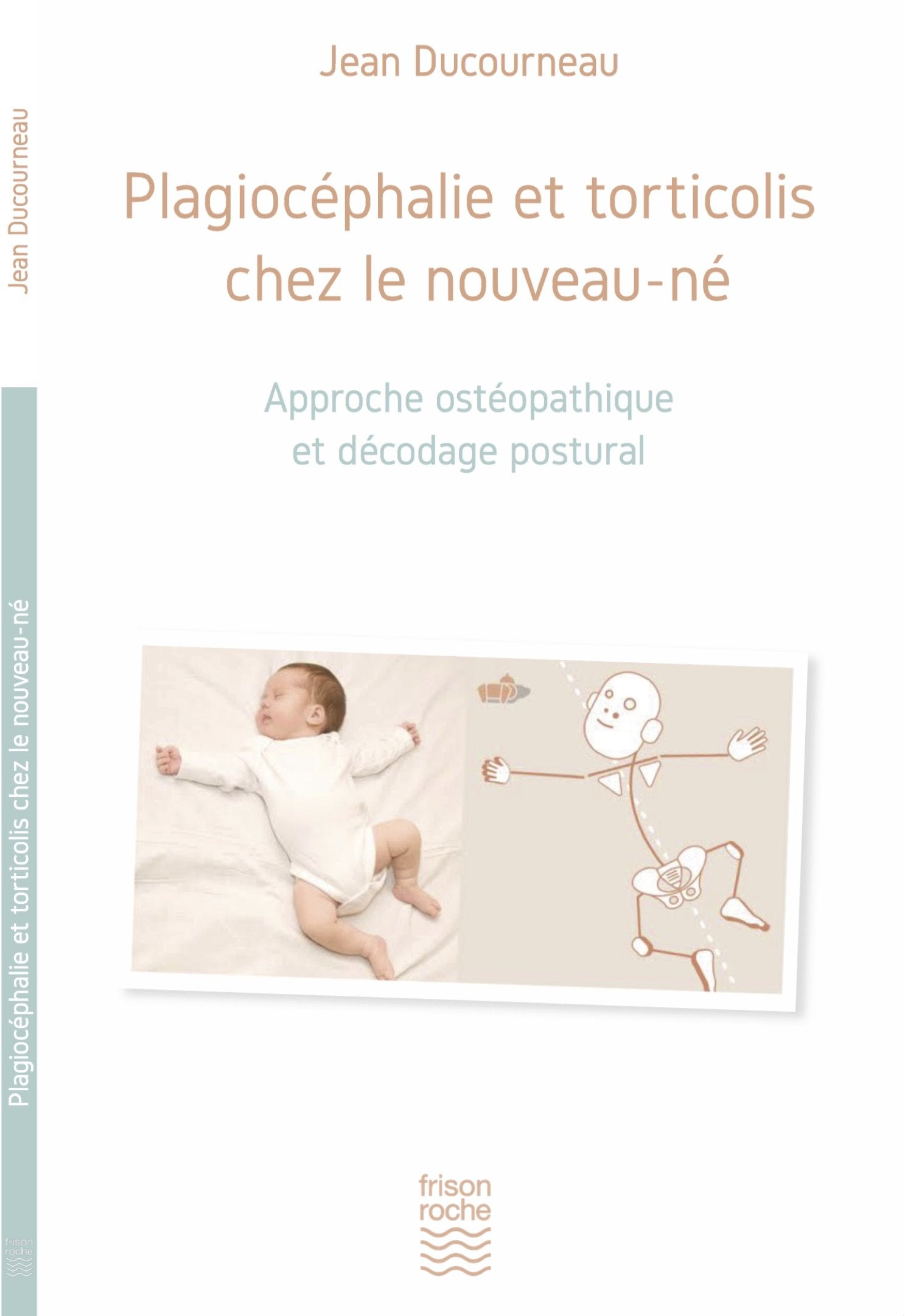 Plagiocéphalie Et Torticolis Chez Le Nouveau-né: Approche Ostéopathique Et Décodage Postural Medicine