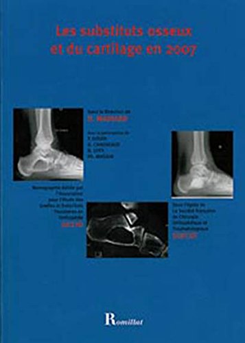 Substituts osseux et du cartilage en 2007 book