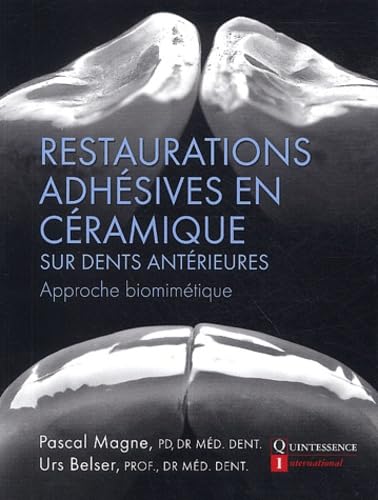 Restauration adhésives en céramique sur dents antérieures: Approche biométrique book