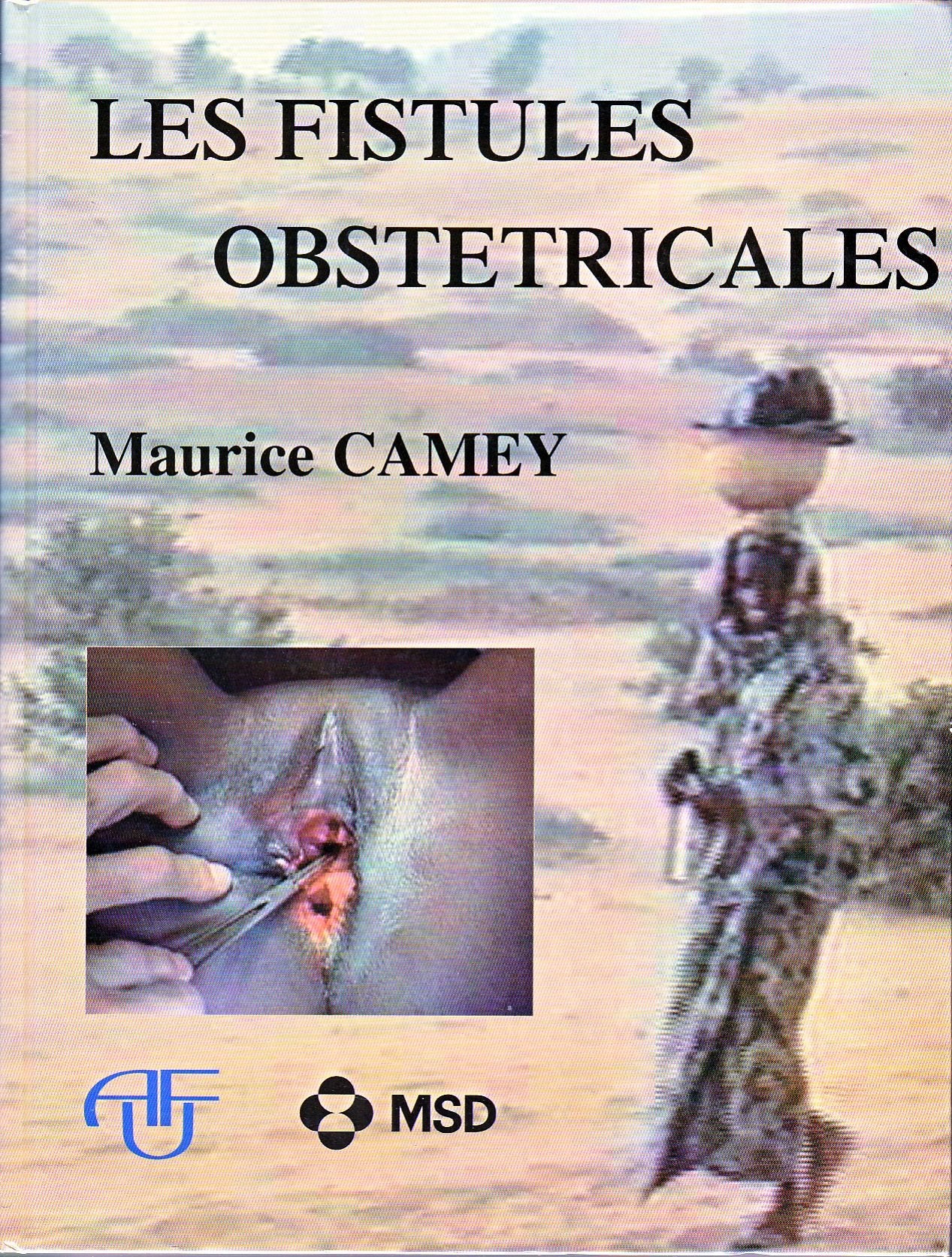 Les fistules obstétricales : à la mémoire de Jean Antoine Robein book