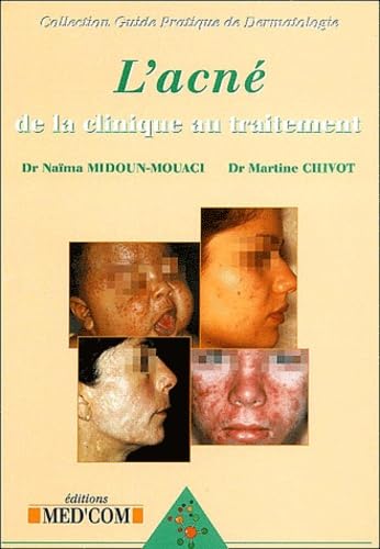 L'acné : de la clinique au traitement book
